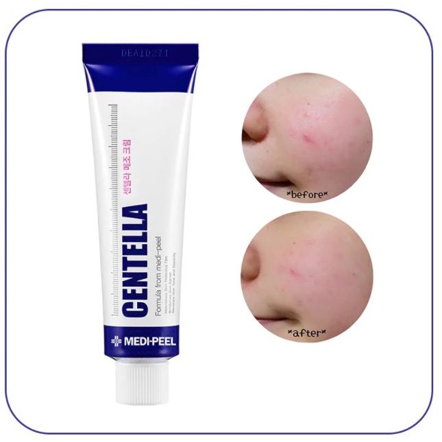 Kem phục hồi da - ngừa mụn Medi-Peel Centella Mezzo Cream 30ml