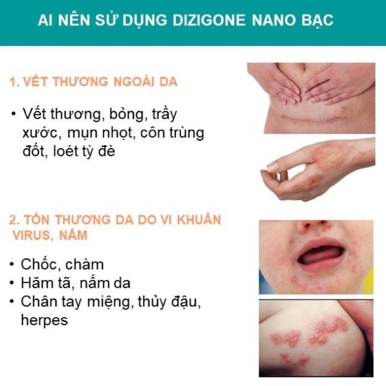 Dizigone spray 100ml - Xịt kháng khuẩn, tái tạo da, ngăn ngừa sẹo | BigBuy360 - bigbuy360.vn