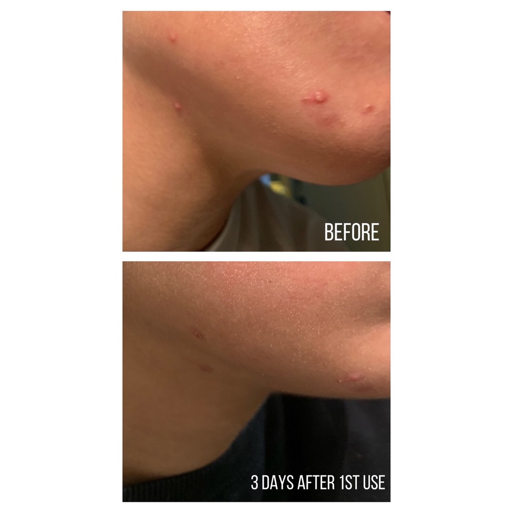 Thanh tẩy da AHA 30% + BHA 2% Peeling Solution The Ordinary 30ml | BigBuy360 - bigbuy360.vn