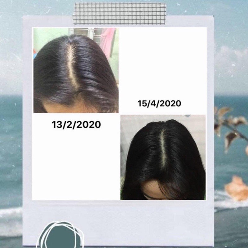 Pro POMELO Hair mist - Xịt kích mọc tóc X2 ( mẫu mới 2021)
