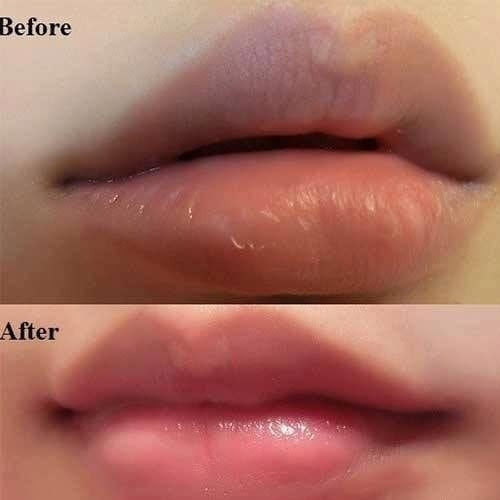 Tẩy Tế Bào Chết Beauty Treats Lip Scrub Giúp Đôi Môi Hồng Hào