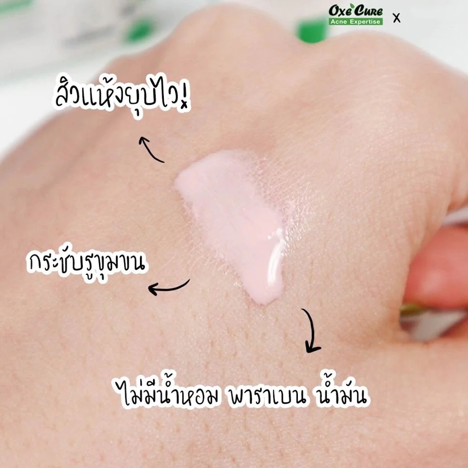 Ngừa mụn Oxe Cure Acne Clear Potion 15ml