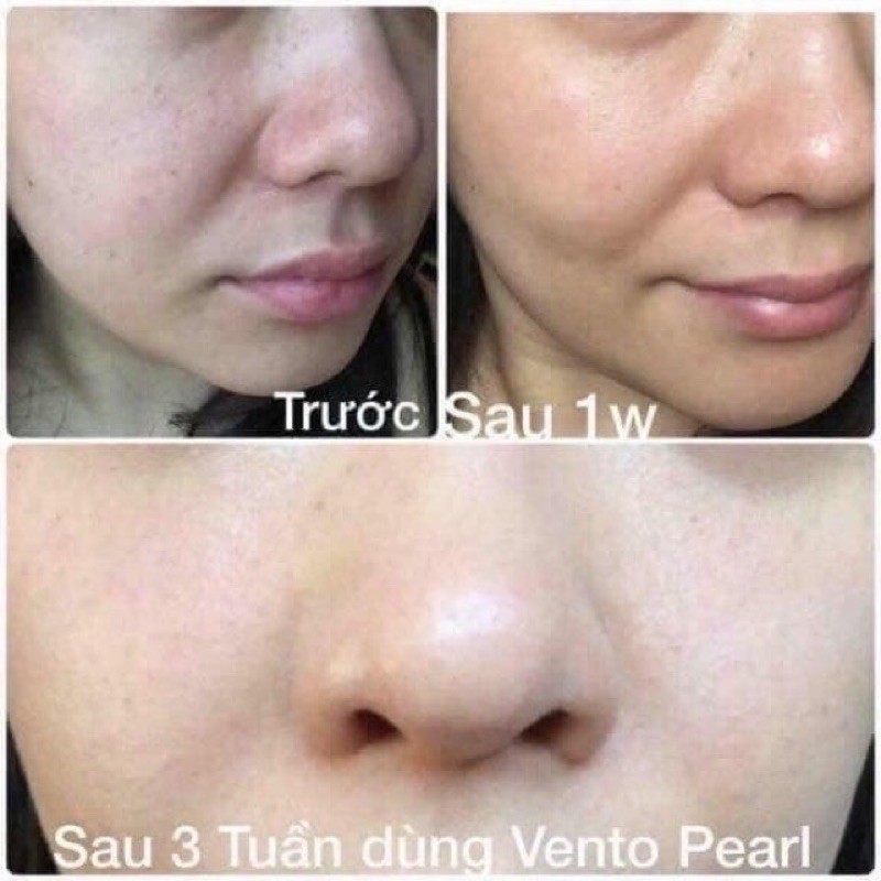 Kem Vento Pearl Trắng Da chính hãng
