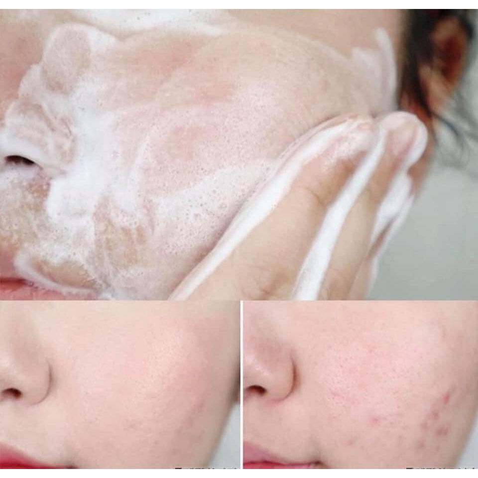 Sữa Rữa Mặt Skin1004 Madagascar Centella Ampoule Foam 125ml