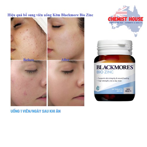 [Mã COS1505 giảm 8% đơn 300K] [Hàng Chuẩn ÚC] Blackmores Bio Zinc - Viên uống bổ sung kẽm tự nhiên 84 viên DATE 2023 | BigBuy360 - bigbuy360.vn