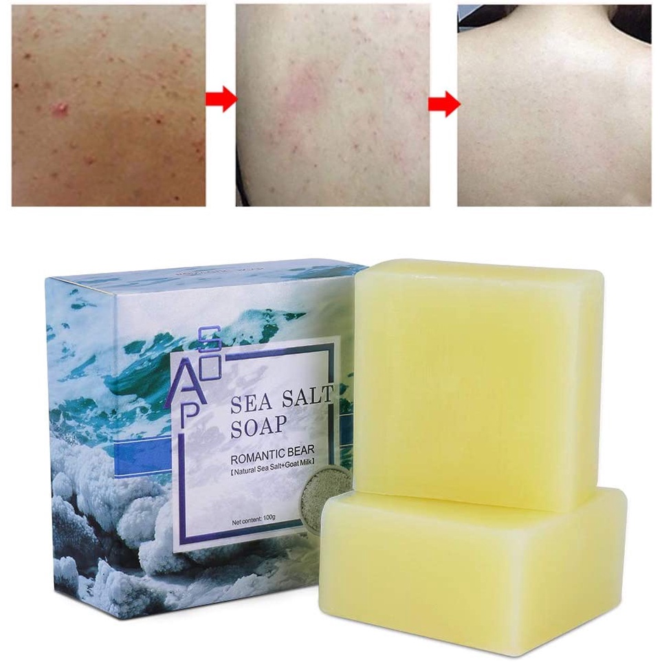 1 Xà Phòng Sữa Dê Tự Nhiên Hỗ trợ giảm mụn Dưỡng Ẩm Thu Nhỏ Lỗ Chân Lông