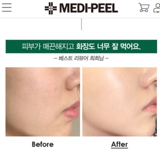 Mặt nạ thảo dược MEDIPEEL 𝐇𝐞𝐫𝐛𝐚𝐥 𝐏𝐞𝐞𝐥 𝐓𝐨𝐱 𝐖𝐚𝐬𝐡 𝐎𝐟𝐟 𝐓𝐲𝐩𝐞 𝐂𝐫𝐞𝐚𝐦 𝐌𝐚𝐬𝐤