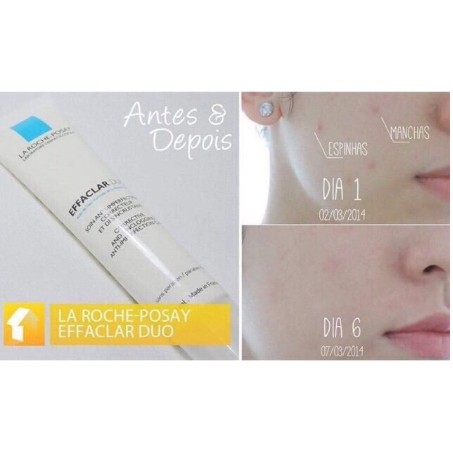 LA ROCHE POSAY KEM MỤN ĐÁNH TAN MỤN TỪ BÊN TRONG,  PHỤC HỒI DA MỜ THÂM HIỆU QUẢ