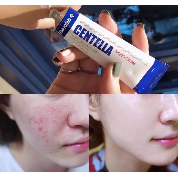 Kem Rau Má Dưỡng Ẩm Ngăn Ngừa Mụn Phục Hồi Da MEDI PEEL CENTELLA MEZZO CREAM