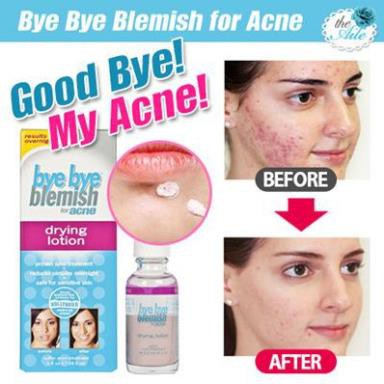 BYE BYE BLEMISH - Kem dưỡng da