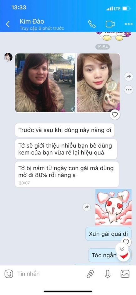 KEM SÂM NHẬT CHÍNH HÃNG - NÁM - MỤN - THÂM - TÀN NHANG HIỆU QUẢ | BigBuy360 - bigbuy360.vn