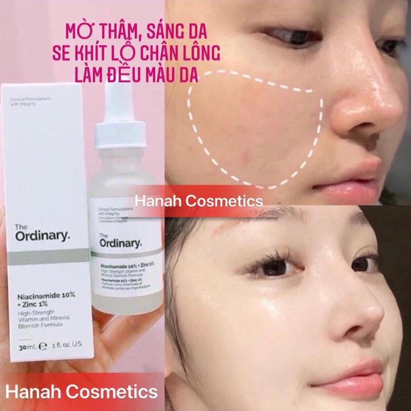 TINH CHẤT THE ORDINARY NIACINAMIDE 10% + ZINC 1% 30ML