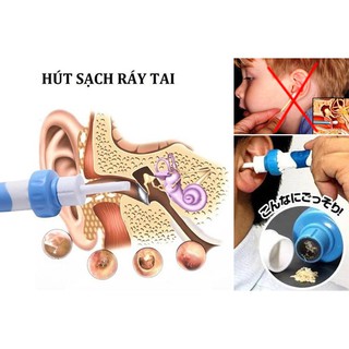Máy hút ráy tai Nhật Bản - lấy ráy tai siêu tiện lợi không ảnh hưởng đến màng nhĩ