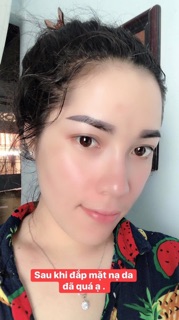 NẠ BẮC NHÂN SÂM HM STORE