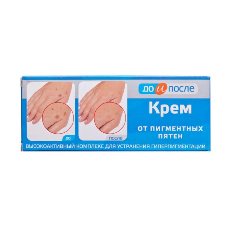 Kem Kprem tay đồi mồi của Nga 50ml