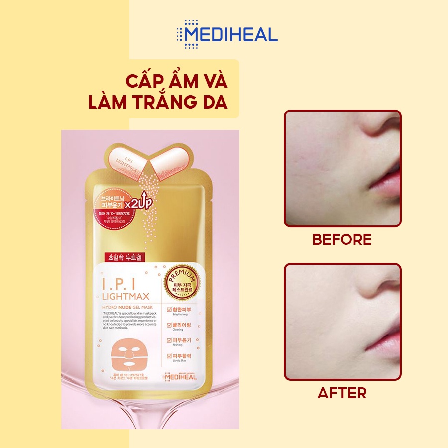 [COMBO 5] Mặt Nạ Gel Cao Cấp Làm Trắng Da Mediheal I.P.I Lightmax Nude Gel Mask 30g [K19]