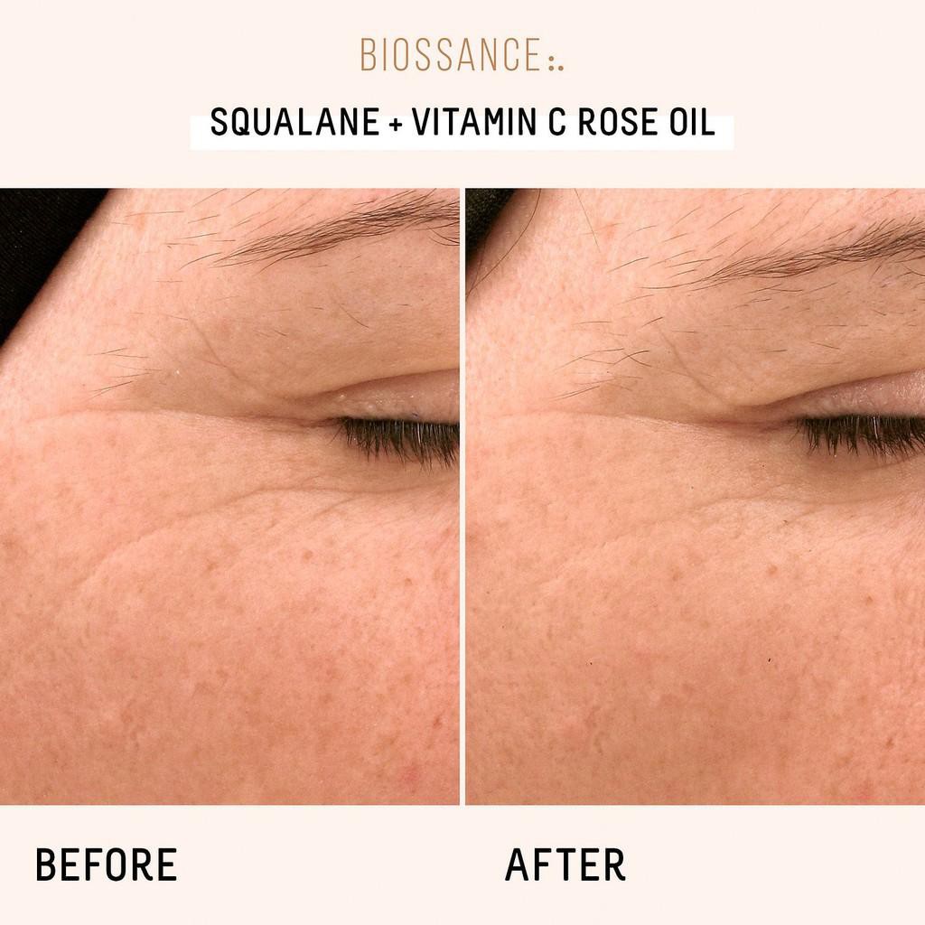 BIOSSANCE 🌿 Dầu dưỡng ẩm sáng da hữu cơ Squalane + Vitamin C Rose Oil