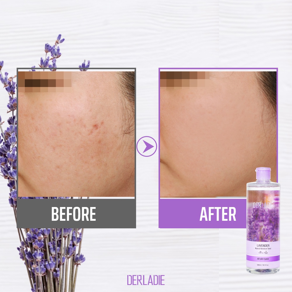 Toner Nước Hoa Hồng Lavender Oải Hương Derladie Lavender Natural Moisture Toner 500ml Nhập Khẩu HÀN QUỐC CHÍNH HÃNG