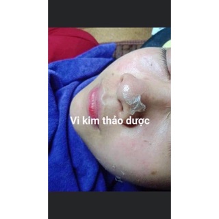 Siêu Vi Kim Thảo Dược Làm Spa