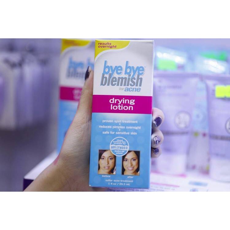 Kem Mụn Bye Bye Blemish Drying Lotion