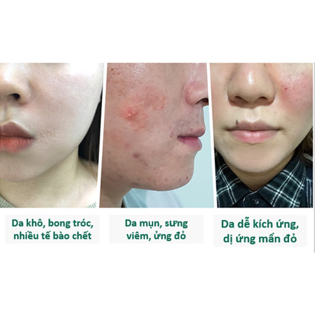 Kem Dưỡng Giảm Mụn Some By Mi AHA-BHA-PHA 30 Days Miracle 50ml