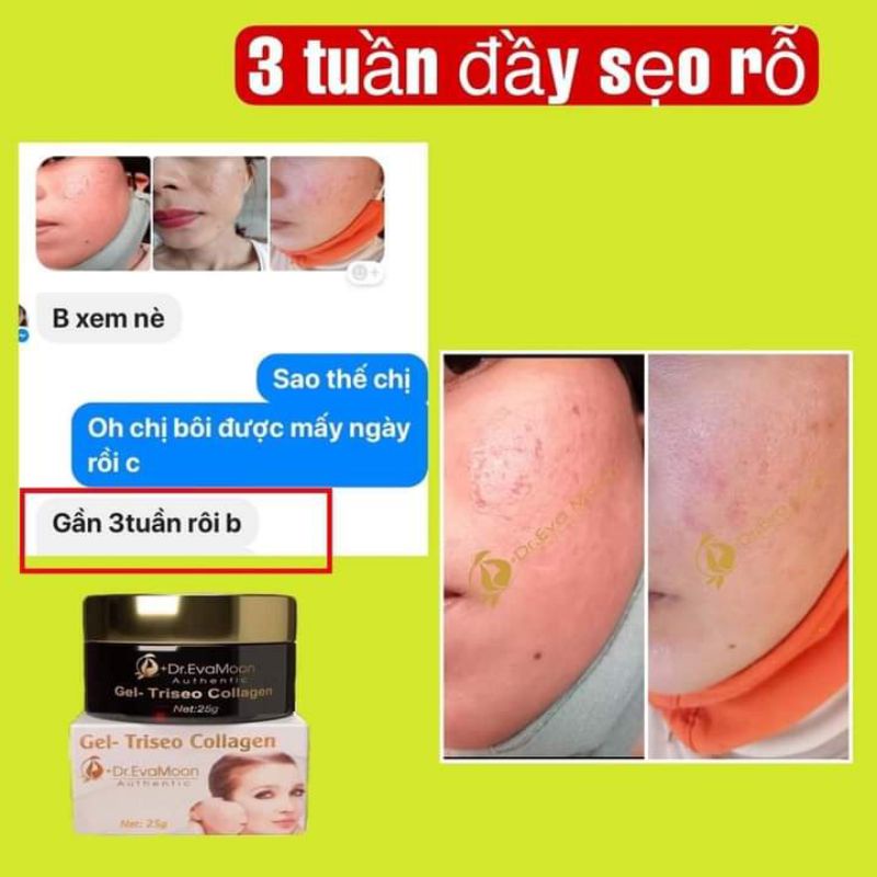 Gel sẹo collagen Dr Eva Mom 25g. Tặng kèm 10 bông tẩy trang