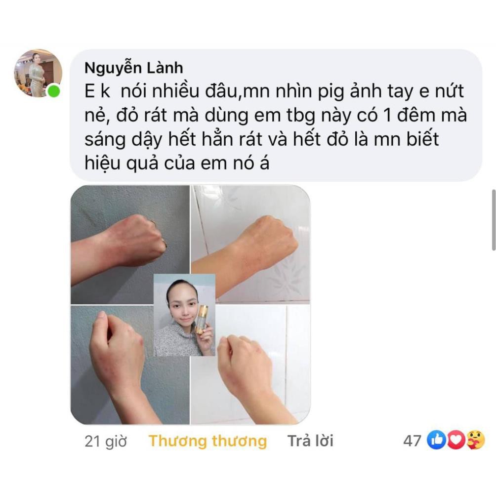 Serum Tế Bào Gốc Placenta Petide Lê Xuân,Chống lão hóa da, xóa nếp nhăn hiệu quả | BigBuy360 - bigbuy360.vn