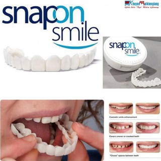 Dụng cụ niềng răng tại nhà snapon smile - nẹp răng tại nhà