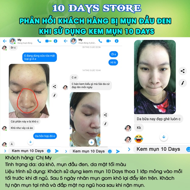 2 lọ kem mụn thảo dược 10  Days chính hãng, sạch mụn ẩn, đầu đen dưỡng da trắng hồng