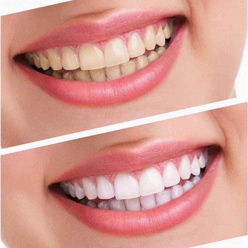 Kem đánh răng làm trắng thơm miệng Crest Complete Extra Whitening Scope