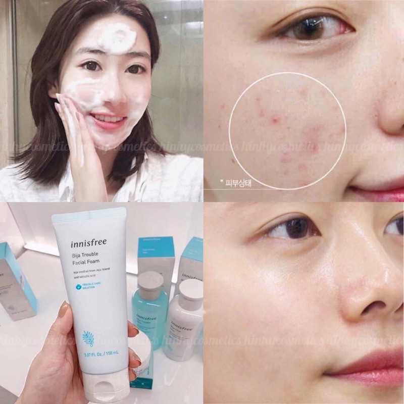 Sữa Rửa Mặt Innisfree Bija Troublr Facial Foam