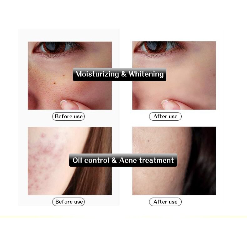 Serum Hydra B5 Essence Rorec  Dưỡng Ẩm, Làm Dịu Da, Căng Bóng, Mịn Màng, Ngừa Mụn, Se Khít Lỗ Chân Lông Chính Hãng
