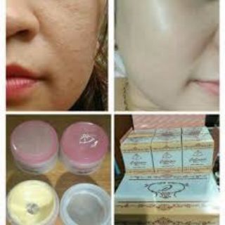 Bộ Kem colagen vit e