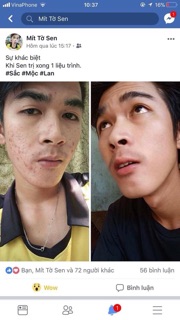 Combo tinh chất + bột rửa mặt sắc mộc lan