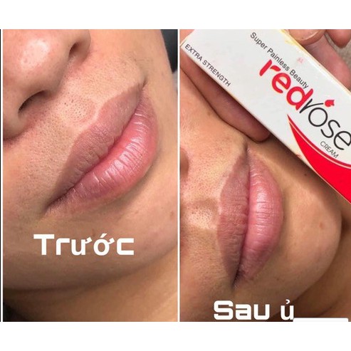 Tuýp Kem RedRose | BigBuy360 - bigbuy360.vn