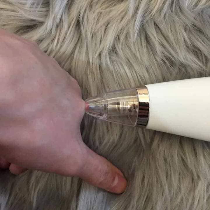 Chuyên sỉ lẻ Máy hút mụn cầm tay LOẠI 1 tích hợp pin | BigBuy360 - bigbuy360.vn