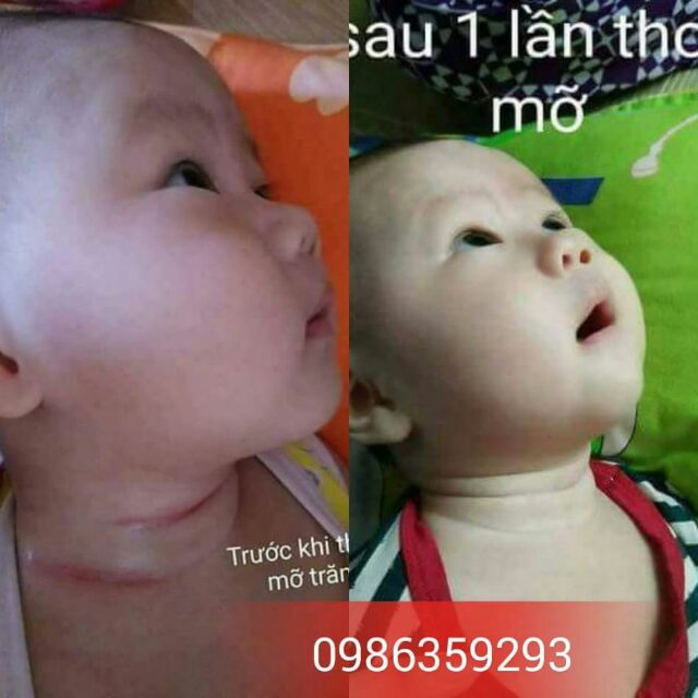 Mỡ trăn nguyên chất dạng hũ | BigBuy360 - bigbuy360.vn