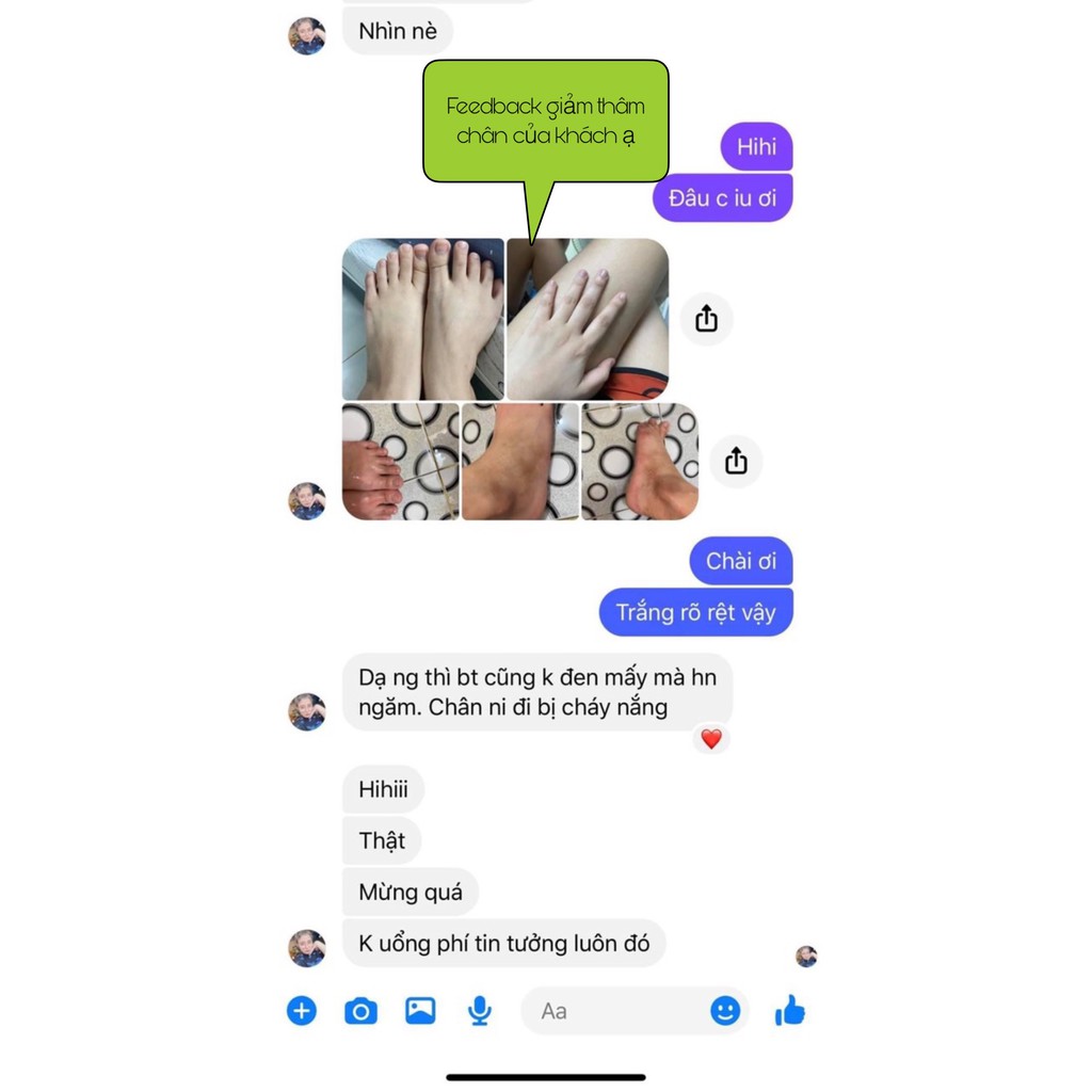 Kem mờ thâm Nách, Bẹn, Mông, Đầu gối Độc quyền