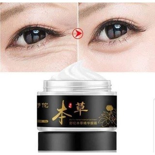 Kem tri mụn thịt đông y
