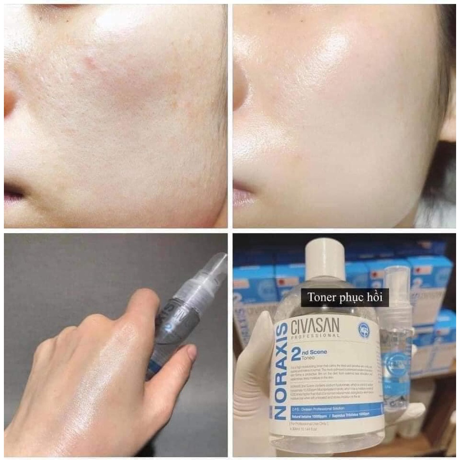 Toner cấp nước phục hồi da Civasan Noraxis 2nd Scene 300ml