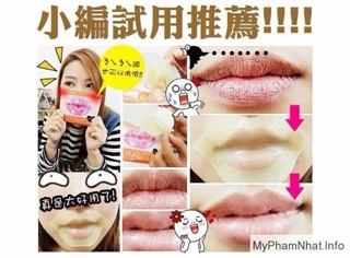 Mặt nạ môi Chossy Nhật Bản
