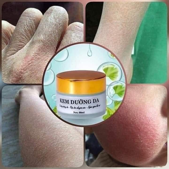 Kem Dưỡng Da Quyên Lara Ngăn Ngừa Da Khô Nẻ,Dưỡng Trắng Da Và Cấp Ẩm Chuyên Sâu 30ml