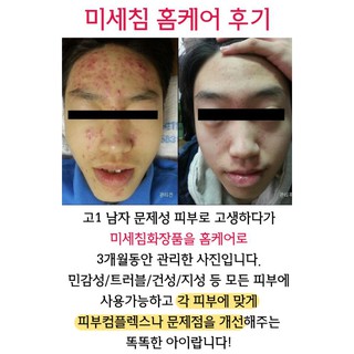 (Bill) Tinh Chất Vi Kim DR. TISHA T2 SERUM