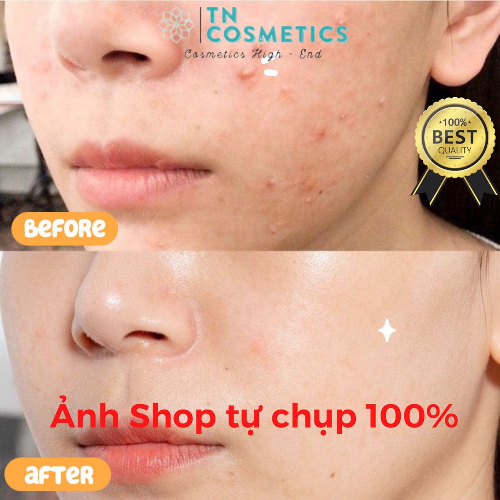 Tinh Chất Cho Da Mụn Chiết Xuất Cây Phỉ Derladie Witch Hazel Perfect Vitamin Serum Mẫu Mới 35ml SR1422