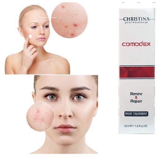 Kem dưỡng ẩm ban đêm Christina giúp phục hồi chuyên sâu tái tạo da dầu mụn 50ml Comodex Renew &amp; Repair Night Treatment