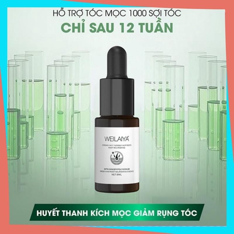 Tinh Dầu Dưỡng Tóc Weilaiya TDWLY102 Kích Thích Mọc Tóc Nhanh Dưỡng Tóc Mọc Nhanh Dài Từ Thảo Dược Thiên Nhiên