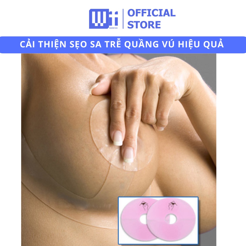 MIẾNG DÁN SẸO QUẦNG VÚ - CẢI THIỆN SẸO SAU THU SA TRỄ ĐƯỜNG QUẦNG VÚ - EPIDERM CLEAR - 1 CẶP TRÒN - CHÍNH HÃNG USA