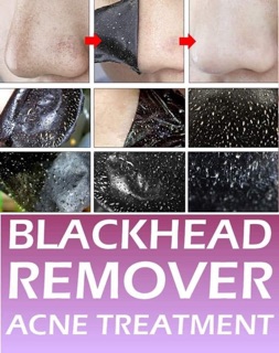 GEL LỘT MỤN BLACK HEAD THÁI LAN