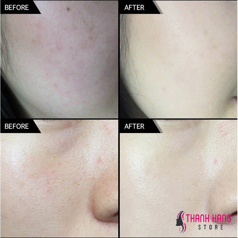 KEM NỀN CATRICE HD 24H | BigBuy360 - bigbuy360.vn