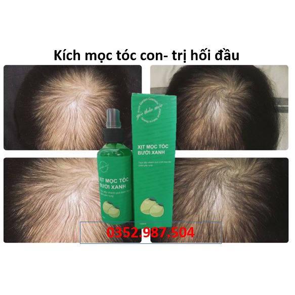 Xịt Mọc Tóc Bưởi Xanh 100ml - Nguyên Mã